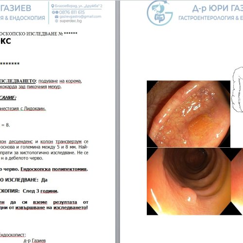 ЕНДОСКОПСКИ ИЗСЛЕДВАНИЯ